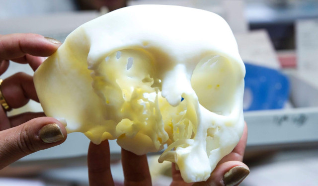 Materialise anatomical model