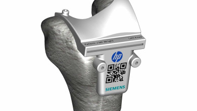 Siemens and HP - Color 3D Printed Surgincal Cutting Guide extended