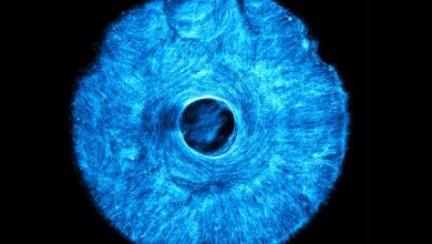 MIT engineers 3D print multidirectional muscle tissue that flexes like the human iris - opening new paths for biohybrid robots.