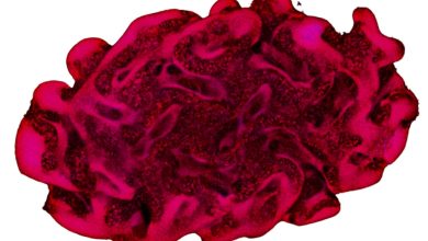 Cellbricks reaches key milestone using Rousselot biomaterials - successfully implanting 3D bioprinted adipose tissue constructs into mice.