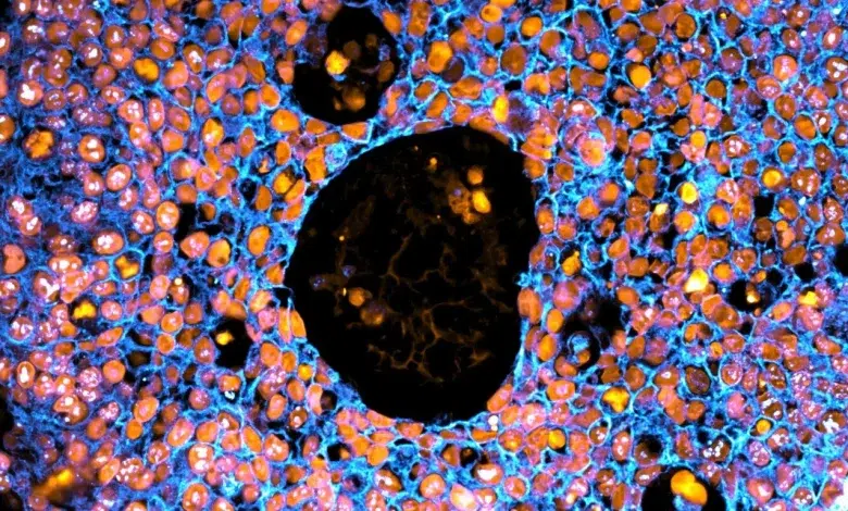 University of Technology Sydney (UTS) scientists 3D bioprint miniature placentas - providing a new way to study complications in pregnancy.