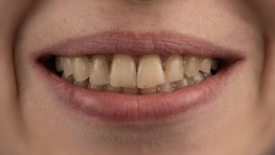 Fidentis debuts clinically used multi-material LPBF dental implant - combining gold and CoCrMo in a single 3D printed prosthetic component.