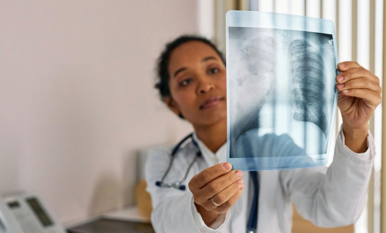 3D printed lungs from USask enable advanced disease research - showing promise for improving the study of tuberculosis and cystic fibrosis.