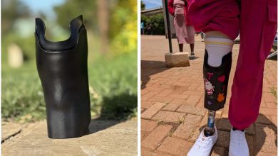 HP The Limb Kind Foundation pilot project 3D printed prosthetic sockets