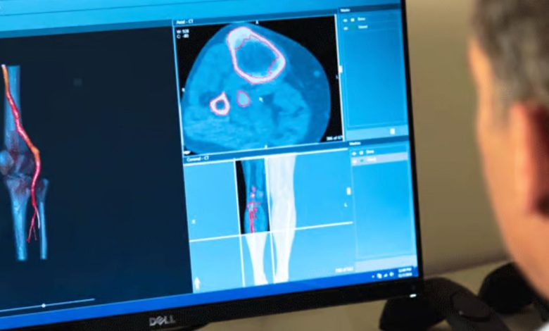 3D Systems achieves FDA 510(k) clearance for VSP Orthopedics - further enabling adoption in the pediatric orthopedic oncology segment.