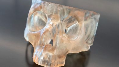Ohio State uses 3D printing to improve cancer surgery precision. Custom anatomical models help surgeons remove bone-invading tumors.