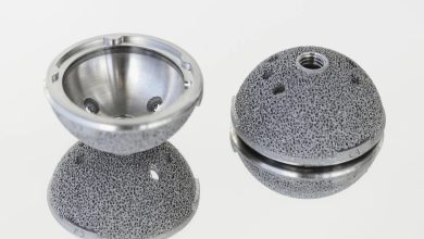 EOS team member receives 3D printed hip implants