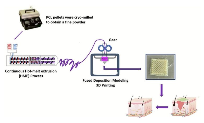 University of Mississippi team develops 3D printed bandages to treat chronic wounds