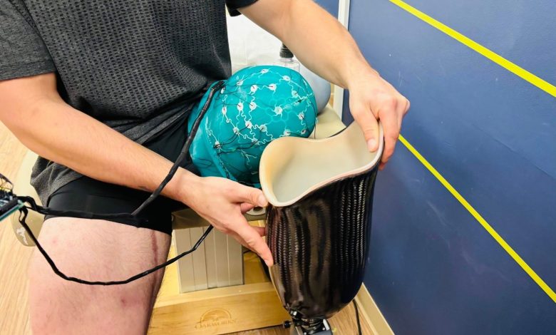 Researchers at Simon Fraser University have developed a 3D printed prosthetic limb socket that uses embedded pressure sensors and artificial intelligence to generate custom socket designs, based on individual patient biomechanics