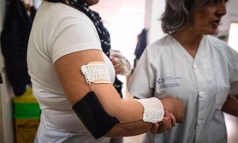 Tenerife hospital using 3D printing to cut rehab equipment costs by up to 97.6%