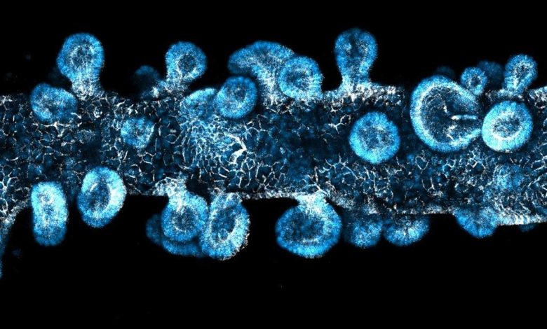 UCSF researchers develop composite to standardize organoid development