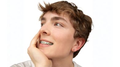 LightForce Orthodontics launches patient-specific 3D printed metal bracket
