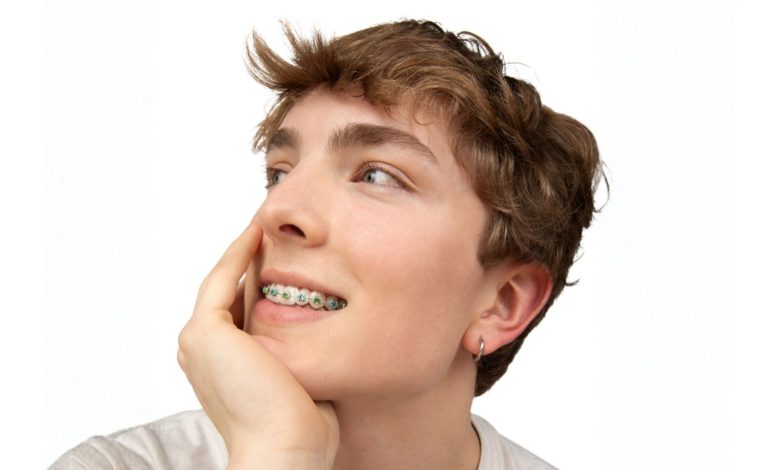 LightForce Orthodontics launches patient-specific 3D printed metal bracket