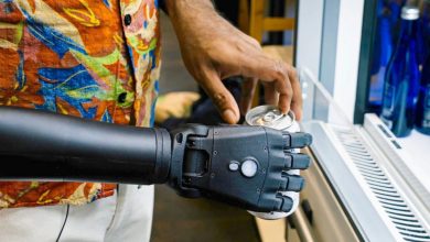 New York amputee becomes first recipient of 3D printed full-length bionic arm