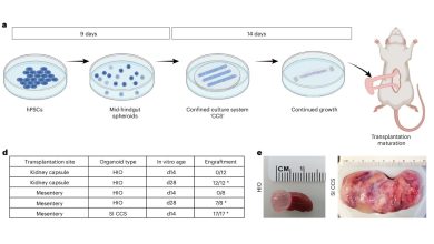 3D printed scaffold from Cincinnati Children's produces gut organoids twice as fast