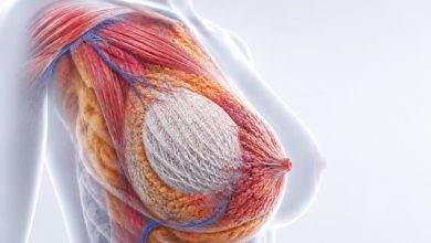 30 women receive 3D printed breast scaffolds in BellaSeno clinical trials
