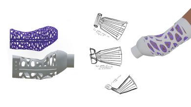 3D printed prosthetic socket system wins Dyson Award